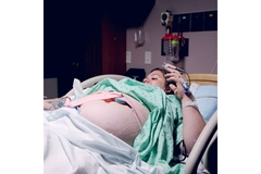 Image Overweight woman in premature labor at hospital